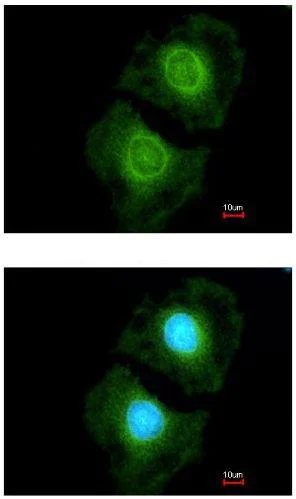 Immunocytochemistry/ Immunofluorescence - Anti-COASY antibody (AB155551)