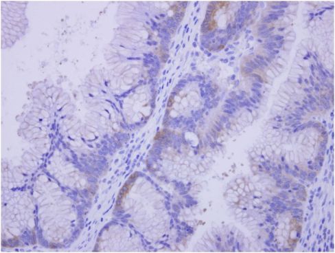 Immunohistochemistry (Formalin/PFA-fixed paraffin-embedded sections) - Anti-COASY antibody (AB155551), expandable thumbnail