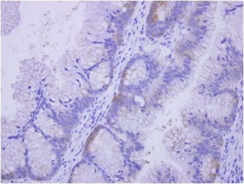 Immunohistochemistry (Formalin/PFA-fixed paraffin-embedded sections) - Anti-COASY antibody (AB155551)