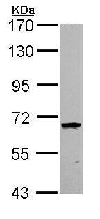 Western blot - Anti-COASY antibody (AB155551), expandable thumbnail