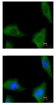 Immunocytochemistry/ Immunofluorescence - Anti-COASY antibody (AB227272)