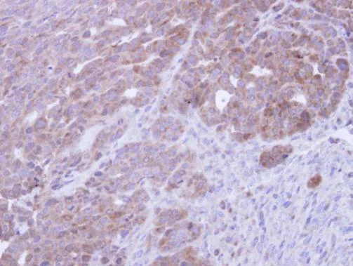 Immunohistochemistry (Formalin/PFA-fixed paraffin-embedded sections) - Anti-COASY antibody (AB227272)