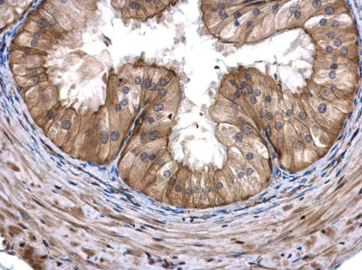 Immunohistochemistry (Formalin/PFA-fixed paraffin-embedded sections) - Anti-COASY antibody (AB227272)