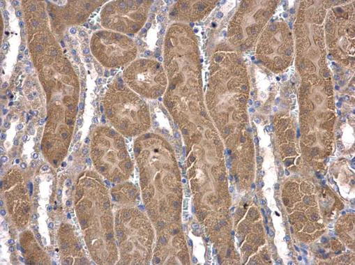 Immunohistochemistry (Formalin/PFA-fixed paraffin-embedded sections) - Anti-COASY antibody (AB227272)