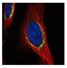 Immunocytochemistry/ Immunofluorescence - Anti-Coatomer subunit delta/COPD antibody (AB96725), expandable thumbnail