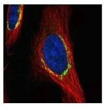 Immunocytochemistry/ Immunofluorescence - Anti-Coatomer subunit delta/COPD antibody (AB96725)