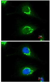 Immunocytochemistry/ Immunofluorescence - Anti-Coatomer subunit delta/COPD antibody (AB96725), expandable thumbnail
