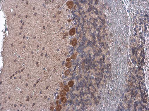 Immunohistochemistry (Formalin/PFA-fixed paraffin-embedded sections) - Anti-Coatomer subunit delta/COPD antibody (AB96725), expandable thumbnail