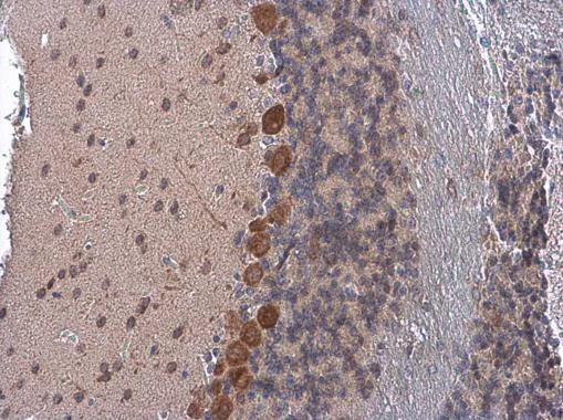 Immunohistochemistry (Formalin/PFA-fixed paraffin-embedded sections) - Anti-Coatomer subunit delta/COPD antibody (AB96725)