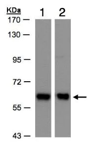 Western blot - Anti-Coatomer subunit delta/COPD antibody (AB96725)