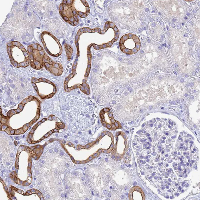 Immunohistochemistry (Formalin/PFA-fixed paraffin-embedded sections) - Anti-COBLL1 antibody (AB254891)