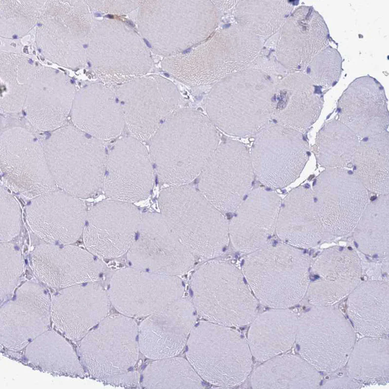Immunohistochemistry (Formalin/PFA-fixed paraffin-embedded sections) - Anti-COBLL1 antibody (AB254891)