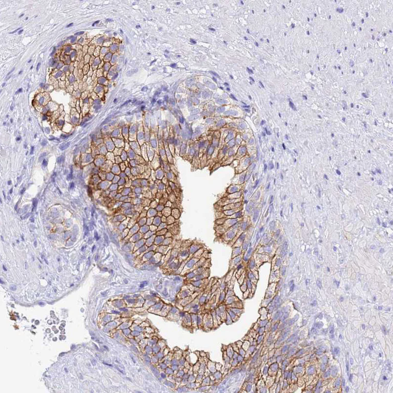 Immunohistochemistry (Formalin/PFA-fixed paraffin-embedded sections) - Anti-COBLL1 antibody (AB254891)