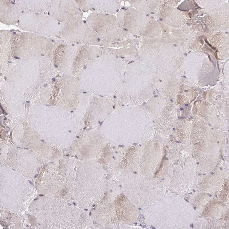 Immunohistochemistry (Formalin/PFA-fixed paraffin-embedded sections) - Anti-COBLL1 antibody (AB272656)