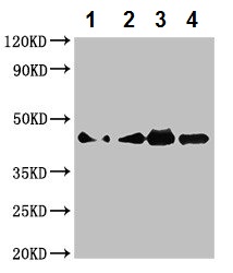 Western blot - Anti-Cobra Venom Factor antibody (AB229942), expandable thumbnail