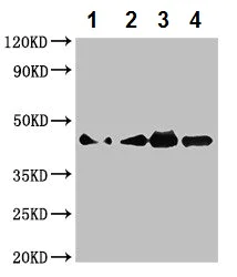 Western blot - Anti-Cobra Venom Factor antibody (AB229942)