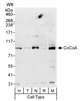 Western blot - Anti-CoCoA antibody (AB70564)