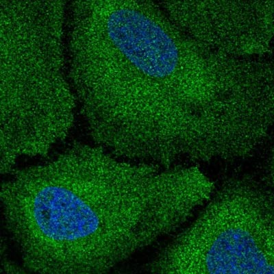 Immunocytochemistry/ Immunofluorescence - Anti-Codanin-1 antibody (AB204392), expandable thumbnail