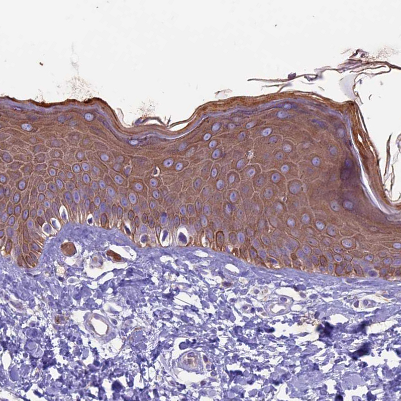 Immunohistochemistry (Formalin/PFA-fixed paraffin-embedded sections) - Anti-Codanin-1 antibody (AB204392), expandable thumbnail