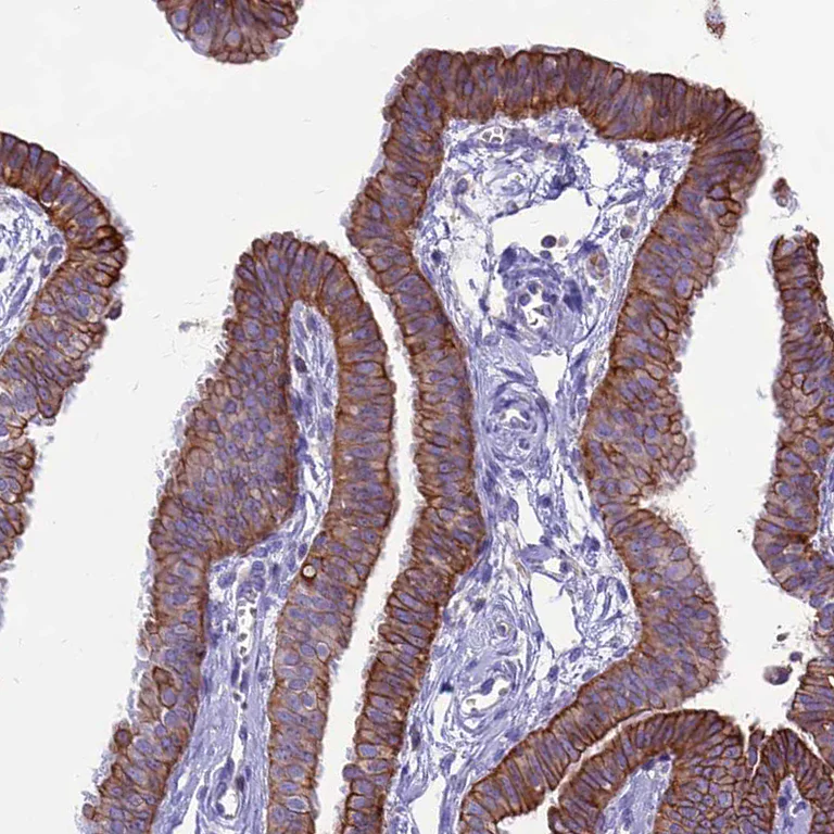 Immunohistochemistry (Formalin/PFA-fixed paraffin-embedded sections) - Anti-Codanin-1 antibody (AB204392)