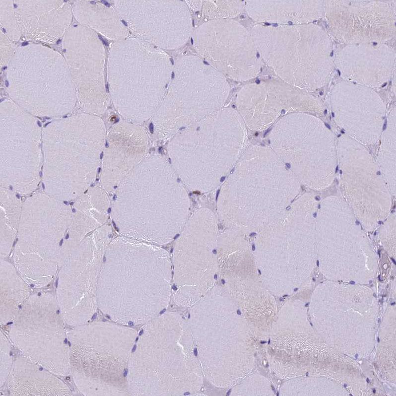 Immunohistochemistry (Formalin/PFA-fixed paraffin-embedded sections) - Anti-Codanin-1 antibody (AB204392), expandable thumbnail