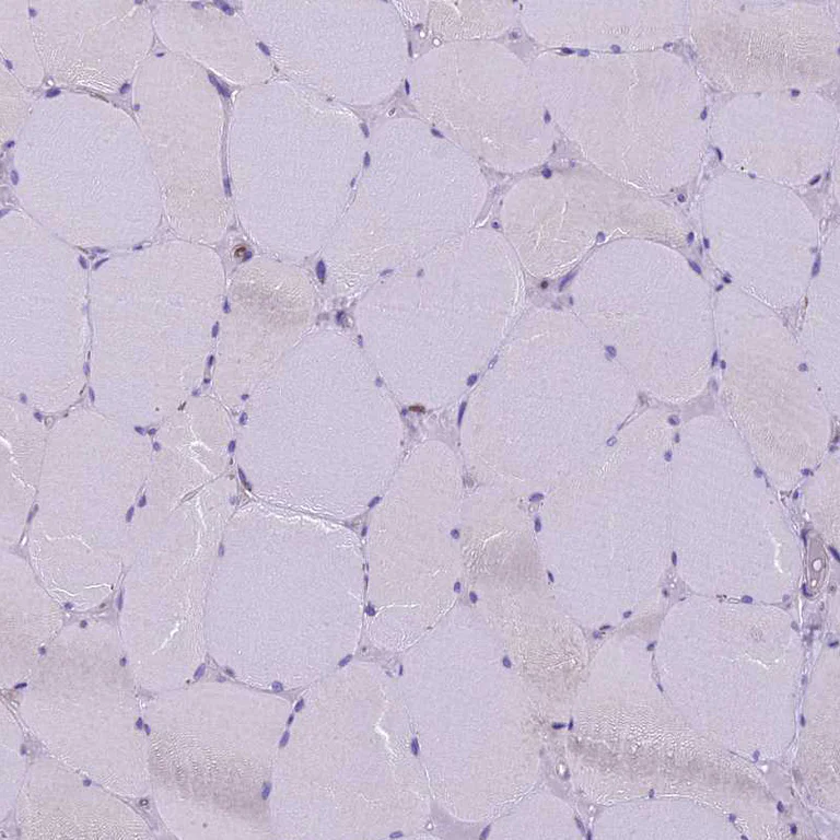 Immunohistochemistry (Formalin/PFA-fixed paraffin-embedded sections) - Anti-Codanin-1 antibody (AB204392)