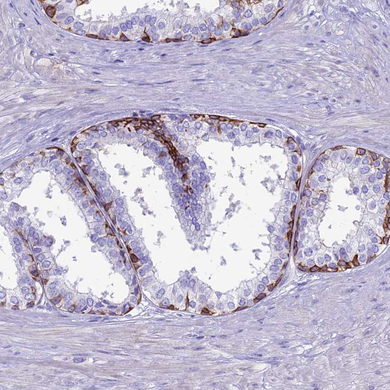 Immunohistochemistry (Formalin/PFA-fixed paraffin-embedded sections) - Anti-Codanin-1 antibody (AB204392), expandable thumbnail