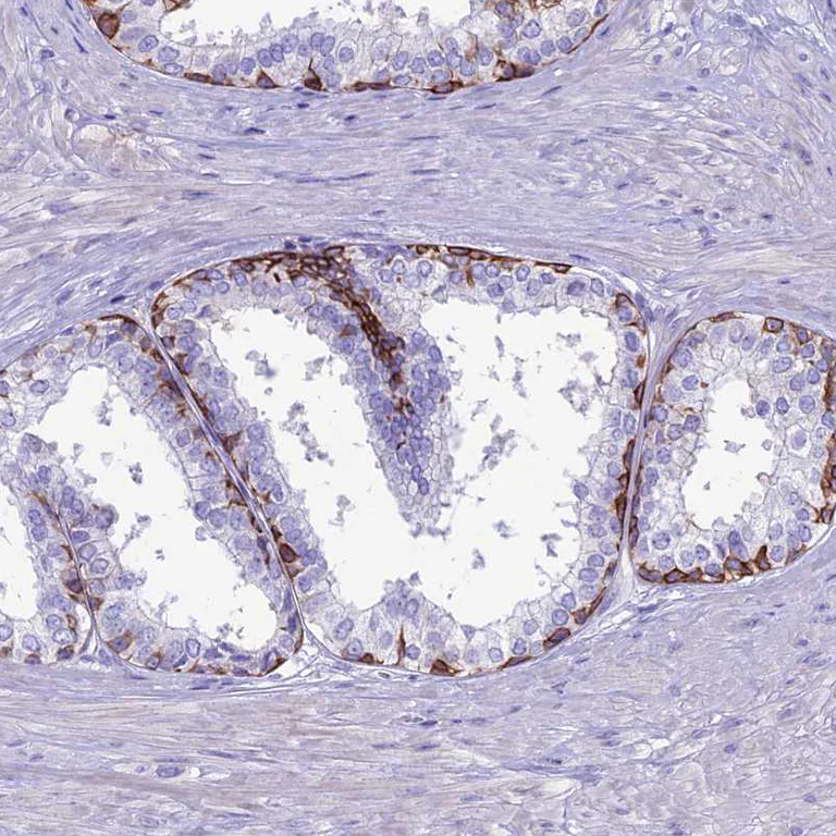 Immunohistochemistry (Formalin/PFA-fixed paraffin-embedded sections) - Anti-Codanin-1 antibody (AB204392)
