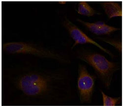 Immunocytochemistry/ Immunofluorescence - Anti-Cofilin 1 + 2 antibody (AB131519), expandable thumbnail