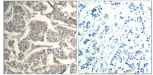 Immunohistochemistry (Formalin/PFA-fixed paraffin-embedded sections) - Anti-Cofilin 1 + 2 antibody (AB131519), expandable thumbnail