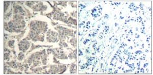 Immunohistochemistry (Formalin/PFA-fixed paraffin-embedded sections) - Anti-Cofilin 1 + 2 antibody - Loading Control (AB131519)