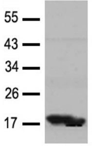 Western blot - Anti-Cofilin 1 + 2 antibody - Loading Control (AB131519), expandable thumbnail