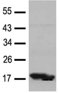 Western blot - Anti-Cofilin 1 + 2 antibody - Loading Control (AB131519)