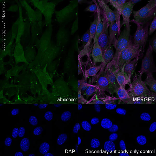 Immunocytochemistry/ Immunofluorescence - Anti-Cofilin-1 antibody [EPR24514-8] - BSA and Azide free (Detector) (AB300185)