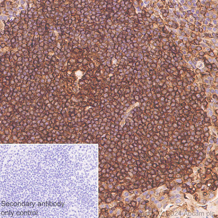 Immunohistochemistry (Formalin/PFA-fixed paraffin-embedded sections) - Anti-Cofilin-1 antibody [EPR24514-8] - BSA and Azide free (Detector) (AB300185)