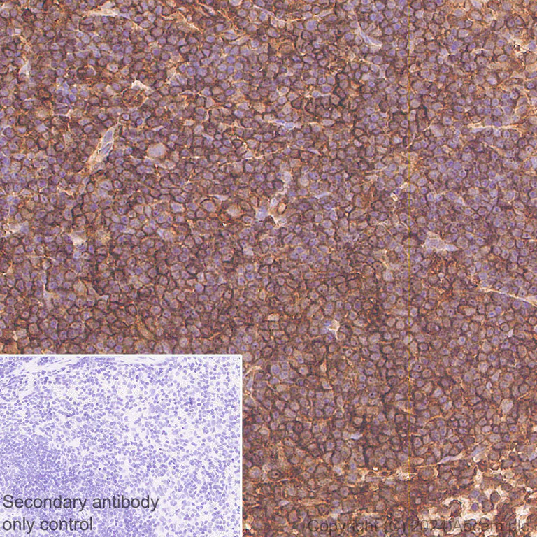 Immunohistochemistry (Formalin/PFA-fixed paraffin-embedded sections) - Anti-Cofilin-1 antibody [EPR24514-8] - BSA and Azide free (Detector) (AB300185)