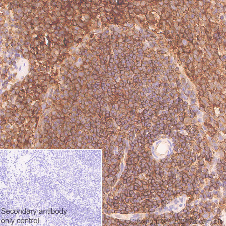 Immunohistochemistry (Formalin/PFA-fixed paraffin-embedded sections) - Anti-Cofilin-1 antibody [EPR24514-8] - BSA and Azide free (Detector) (AB300185)