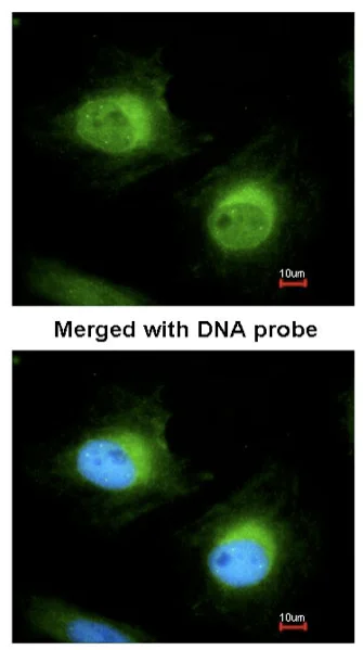 Immunocytochemistry/ Immunofluorescence - Anti-Cofilin 2 antibody (AB96678)