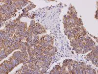 Immunohistochemistry (Formalin/PFA-fixed paraffin-embedded sections) - Anti-Cofilin 2 antibody (AB96678)