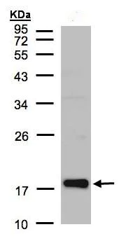 Western blot - Anti-Cofilin 2 antibody (AB96678)