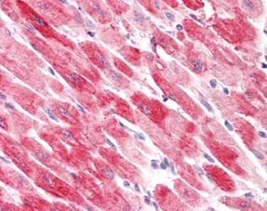 Immunohistochemistry (Formalin/PFA-fixed paraffin-embedded sections) - Anti-Cofilin 2 antibody - C-terminal (AB179935)