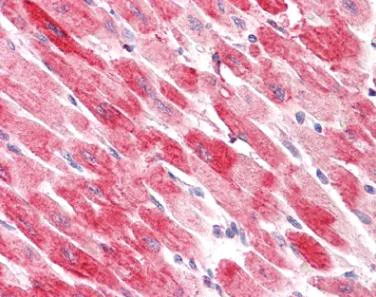 Immunohistochemistry (Formalin/PFA-fixed paraffin-embedded sections) - Anti-Cofilin 2 antibody - C-terminal (AB179935)