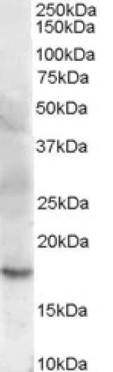 Western blot - Anti-Cofilin 2 antibody - C-terminal (AB179935)