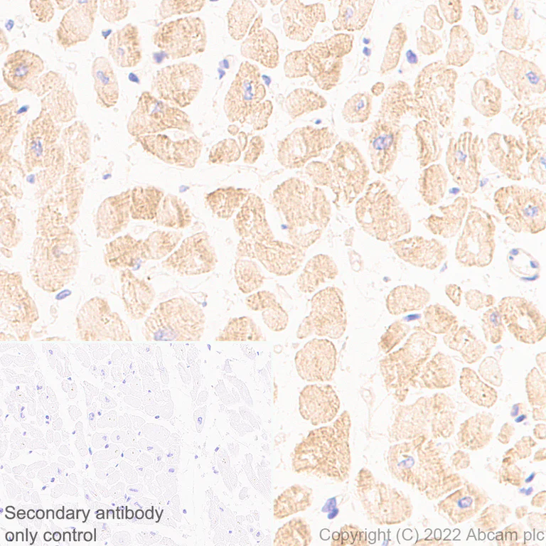 Immunohistochemistry (Formalin/PFA-fixed paraffin-embedded sections) - Anti-Cofilin 2 antibody [EPR24519-7] (AB300128)