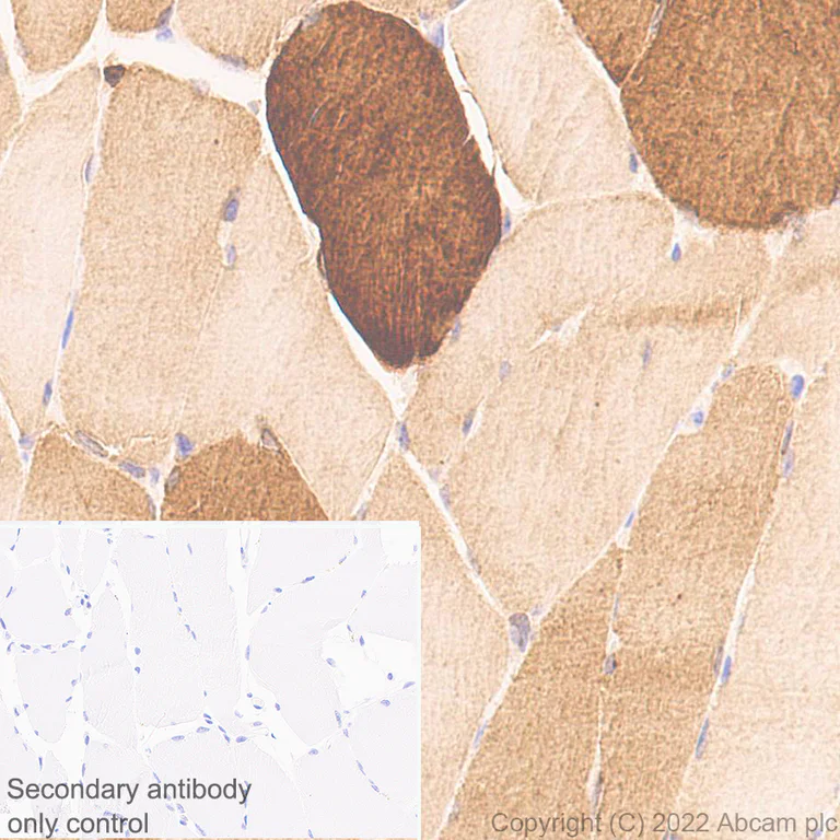 Immunohistochemistry (Formalin/PFA-fixed paraffin-embedded sections) - Anti-Cofilin 2 antibody [EPR24519-7] (AB300128)