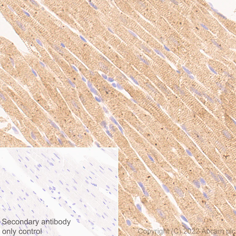 Immunohistochemistry (Formalin/PFA-fixed paraffin-embedded sections) - Anti-Cofilin 2 antibody [EPR24519-7] (AB300128)