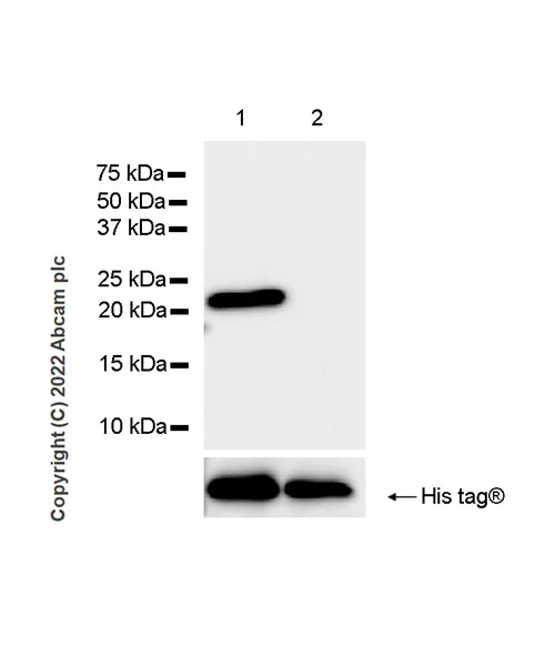 Western blot - Anti-Cofilin 2 antibody [EPR24519-7] (AB300128)