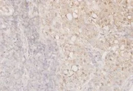 Immunohistochemistry (Formalin/PFA-fixed paraffin-embedded sections) - Anti-Cofilin antibody [1A1] - Loading Control (AB54532)