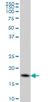 Western blot - Anti-Cofilin antibody [1A1] - Loading Control (AB54532)
