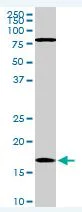 Western blot - Anti-Cofilin antibody [1A1] - Loading Control (AB54532)